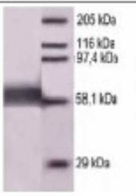 Western Blot: Measles nucleoprotein Antibody [NBP2-42701] - Immunoblot analysis of purified recombinant NP